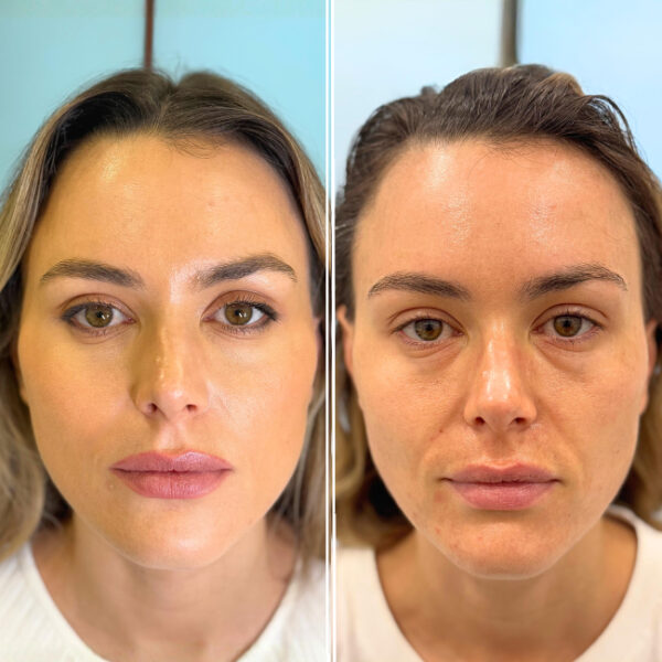 Dermatology Consultations and Treatments